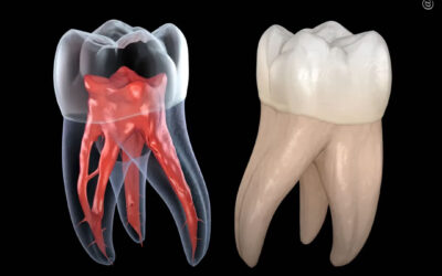 A combinação de THC e CBD reduz a inflamação e auxilia na reparação da polpa dentária em células humanas, revela estudo